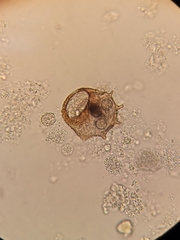 Arcella