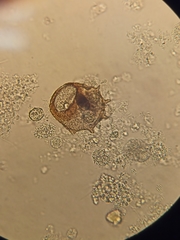 Arcella