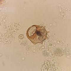 Arcella