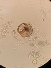 Arcella