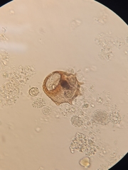 Arcella