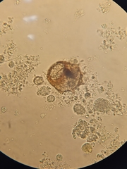 Arcella