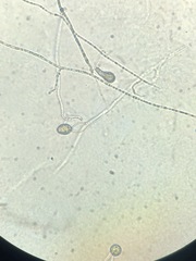 Pythium