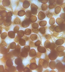 Fossombronia wondraczekii