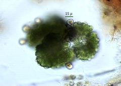 Chytridiomycota