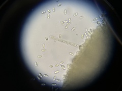 Lanzia luteovirescens