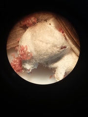 Eriococcus
