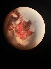 Eriococcus