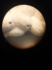 Eriococcus
