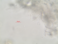 Lepiota castanescens