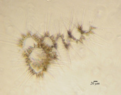 Asterionellopsis glacialis