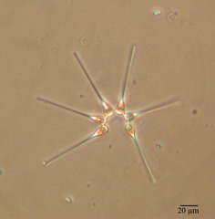 Asterionellopsis glacialis