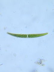 Closterium leibleinii