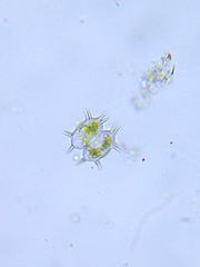 Xanthidium antilopaeum