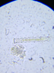 Pleurotaenium nodosum