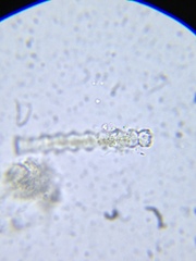 Pleurotaenium nodosum