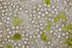 Entyloma gaillardianum