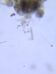 Pleurotaenium nodosum