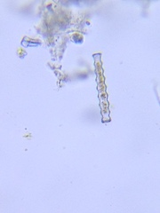 Pleurotaenium nodosum