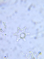 Staurastrum cerastes