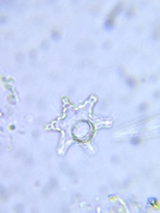 Staurastrum cerastes