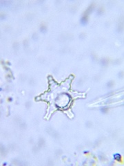 Staurastrum cerastes