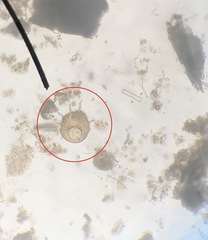 Centropyxis aculeata