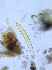 Closterium baillyanum
