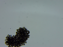 Dolichospermum lemmermannii