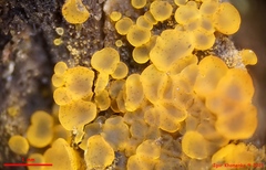 Orbilia xanthostigma