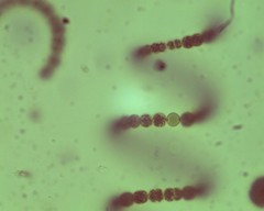 Dolichospermum spiroides