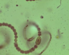 Dolichospermum spiroides