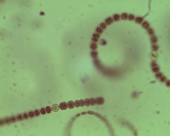 Dolichospermum spiroides