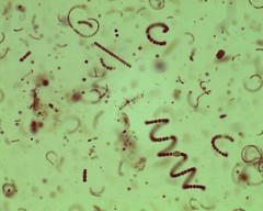 Dolichospermum spiroides