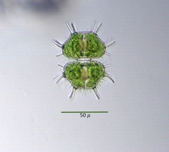 Xanthidium cristatum