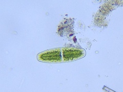 Netrium digitus