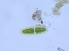 Netrium digitus