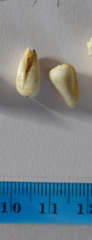 Imbricaria