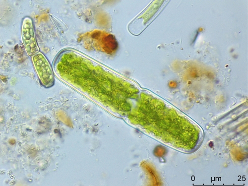 Penium cylindrus