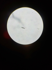 Strongyloides papillosus