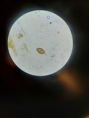 Trichuris