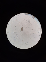 Trichuris vulpis