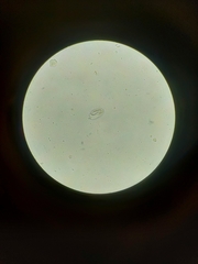 Strongyloides papillosus