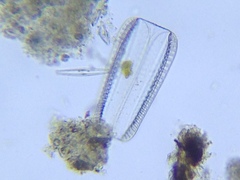 Diatomella