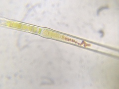 Microchaete