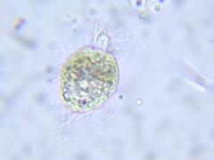 Intramacronucleata