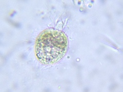 Intramacronucleata
