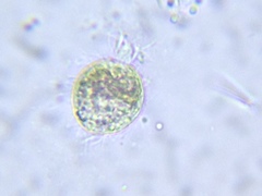 Intramacronucleata
