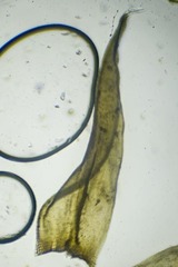 Racomitrium ericoides