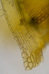 Racomitrium ericoides